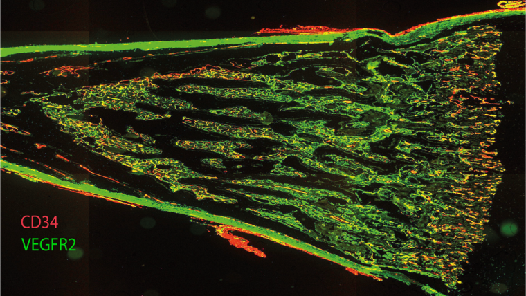 A longitudinal section of fetal femur with multiplex immunofluorescent staining, showing CD34 in red and VEGFR2 in green.