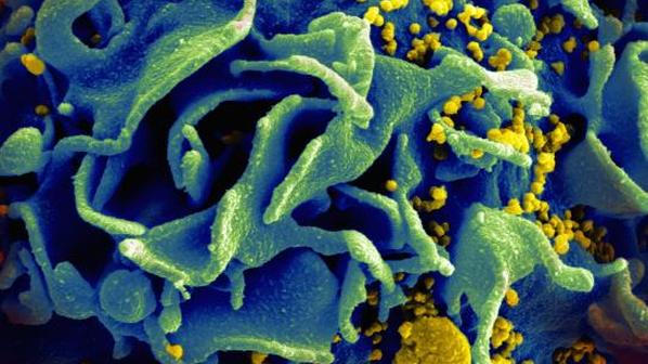 HIV infected T Cell