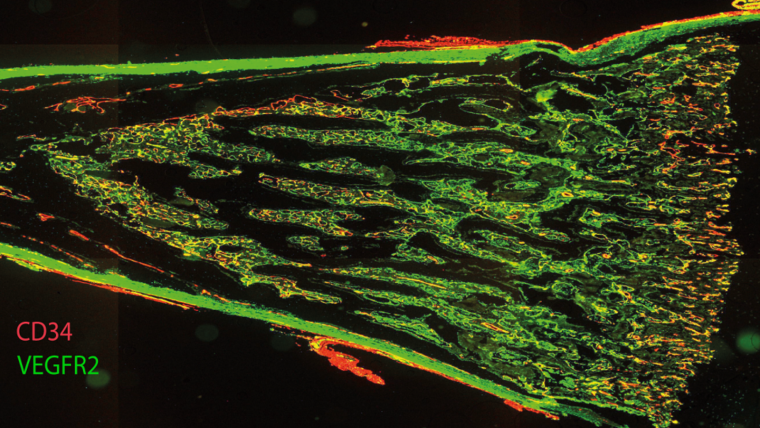 A longitudinal section of fetal femur with multiplex immunofluorescent staining, showing CD34 in red and VEGFR2 in green.